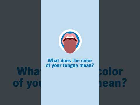 What does the color of your tongue mean? 👅 [Video]