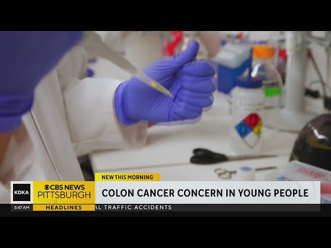 Colon cancer concern in young people [Video]