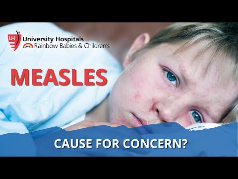 Current State of Measles in the United States [Video]