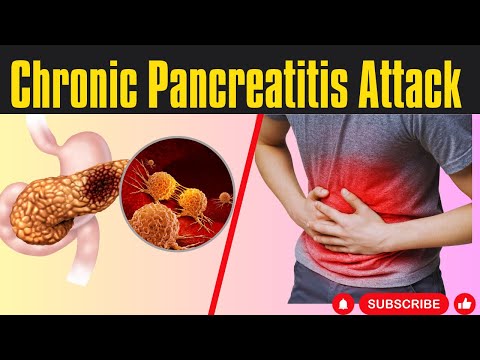 Chronic pancreatitis symptoms and complications | How to know if you have pancreatitis [Video]