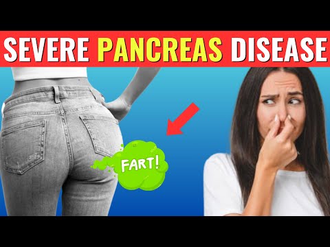 9 EARLY Warning Signs of Pancreatic Cancer You MUST NOT IGNORE! [Video]
