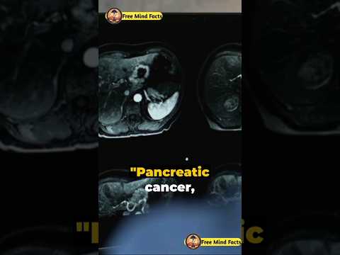 Pancreatic Cancer: The Silent Killer You Need to Know About [Video]
