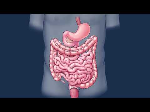 Health Check – Colorectal Cancer Awareness [Video]