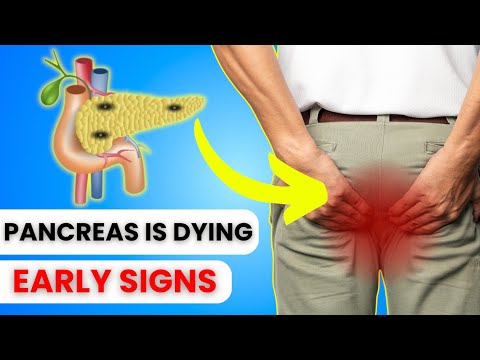 Early Warning Signs of Pancreatic Disease You Shouldn’t Ignore | Catch On QUICKLY! [Video]