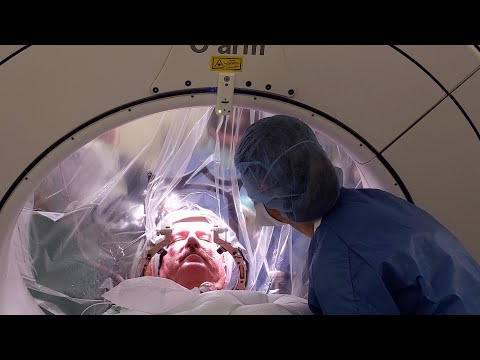 Robotic Neurosurgery at UC Davis Health — The First Comprehensive Program in the Region [Video]