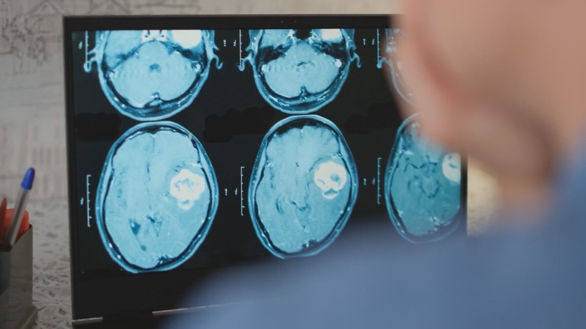 Potential game-changer discovered to fight brain cancer at MSU [Video]