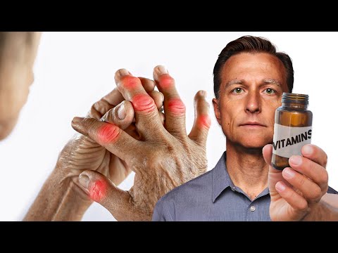 The #1 Best Vitamin for Arthritis (NOT VITAMIN D) [Video]