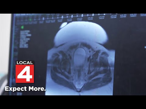 Colon cancer on the rise in younger Americans [Video]