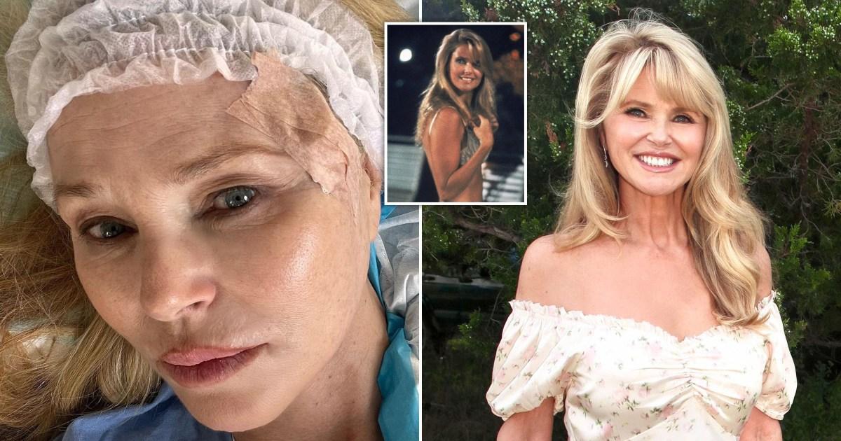 Christie Brinkley reveals skin cancer diagnosis with graphic photos [Video]