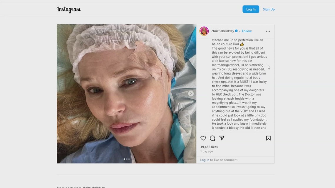 Christie Brinkley’s skin cancer diagnosis highlights importance of early protection [Video]