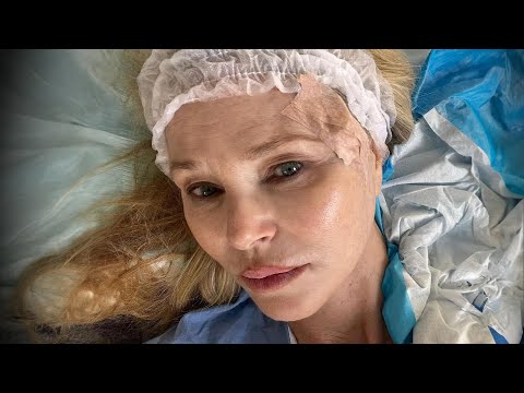Christie Brinkley Reveals She Has Skin Cancer [Video]