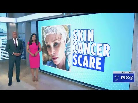 Christie Brinkley skin cancer scare [Video]