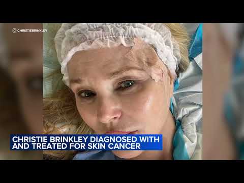 Actress Christie Brinkley diagnosed with cancer [Video]