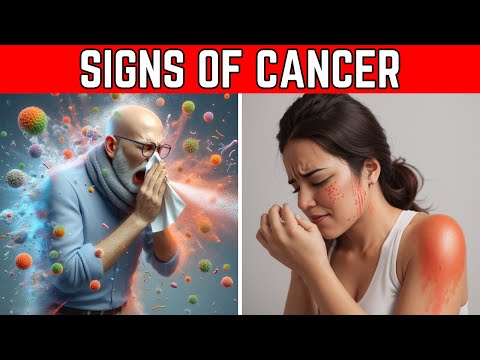 10 Signs of Cancer You Should Not Ignore [Video]