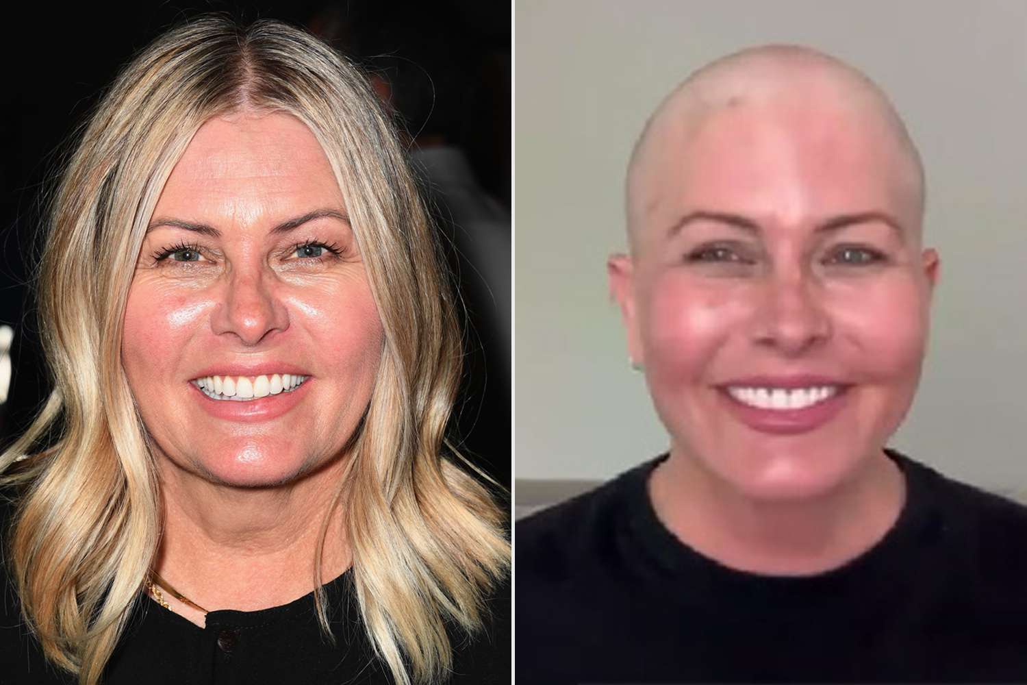 Nicole Eggert Shaves Her Head Following Breast Cancer Diagnosis [Video]