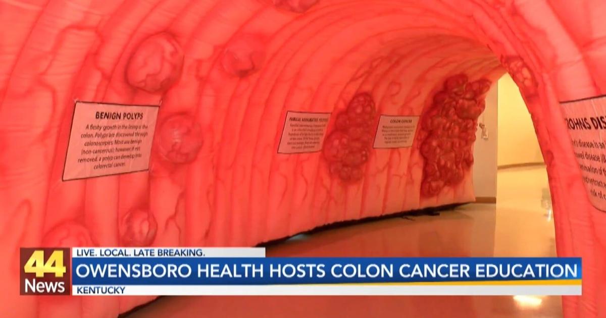 Informative Colon Cancer Event showcases 20-foot inflatable colon | Video