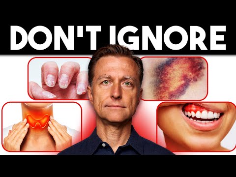 16 Signs That the Body Needs More Nutrients: Fixing the Deeper Cause [Video]