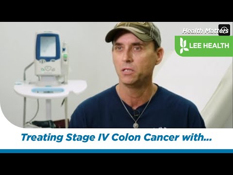 Treating Stage IV Colon Cancer with HAI Pump [Video]