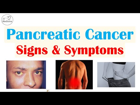 Pancreatic Cancer Signs & Symptoms (& Why They Occur) [Video]