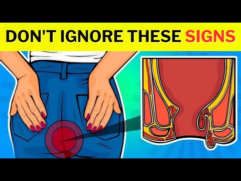 EARLY SIGNS of COLON CANCER that YOU MUST NOT IGNORE [Video]