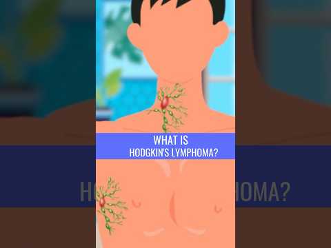 What is HODGKIN’S LYMPHOMA? [Video]