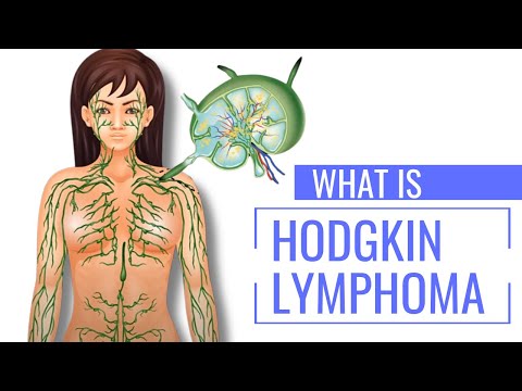 What is Hodgkin’s Lymphoma: First Symptoms Explained | The Patient Story [Video]