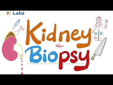 Kidney Biopsy (Taking a Sample of the Kidney) [Video]