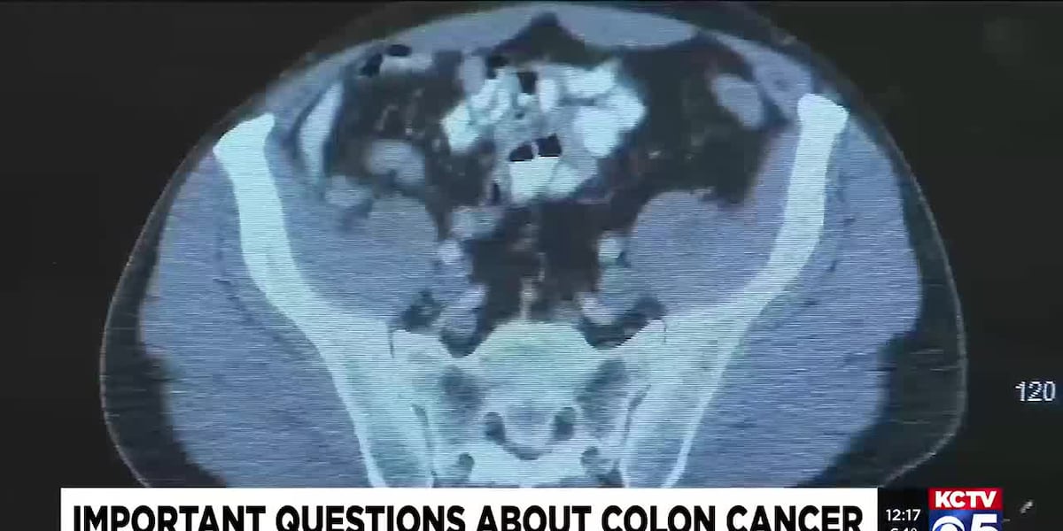 Its Your Health: Important Questions About Colon Cancer [Video]