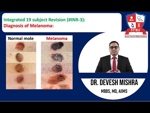 🕉 Integrated 19 subject Revision (#INR-3): Diagnosis of Melanoma by Dr. Devesh Mishra. [Video]
