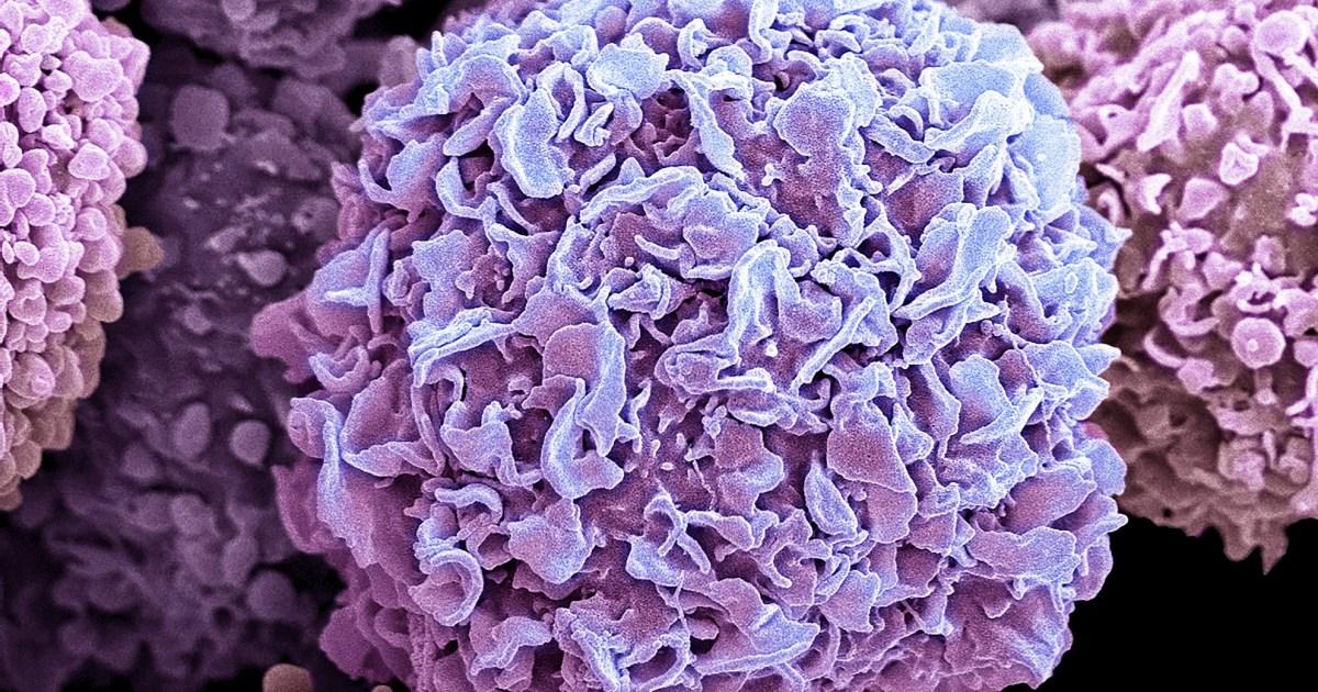 Breast cancer breakthrough could stop ‘hibernating’ cells causing relapses | Tech News [Video]
