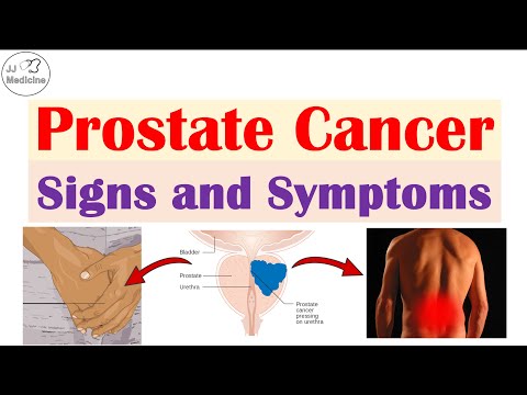 Prostate Cancer Signs and Symptoms (Urinary, Sexual & Metastatic Symptoms) [Video]