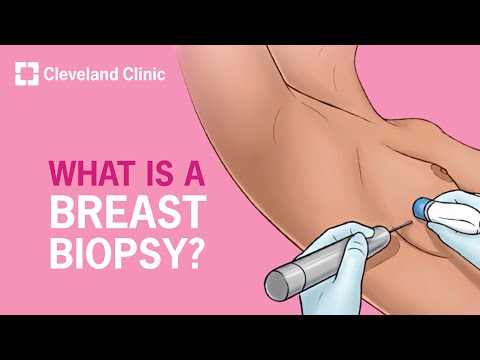 Breast Biopsy: Step-By-Step Explanation [Video]