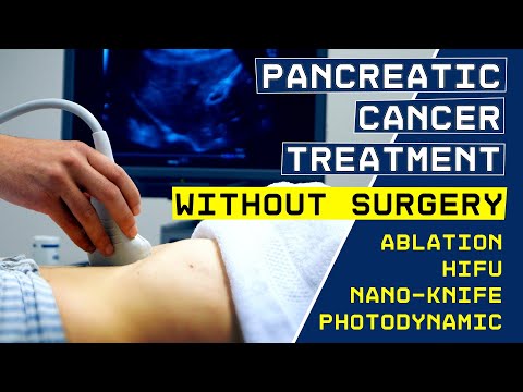 Pancreatic Cancer: how to destroy it. Treatment without surgery [Video]
