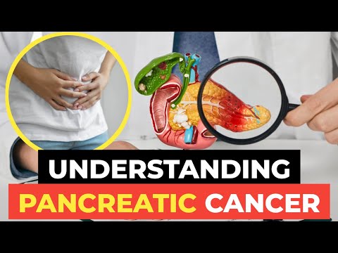 Pancreatic Cancer: The Silent Killer You Need to Know About [Video]