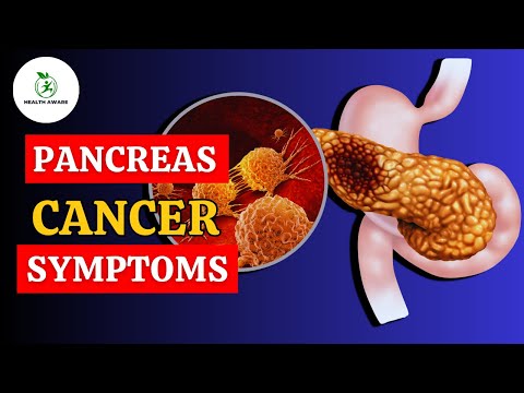 Shocking Secrets: Doctors Hide Pancreatic Cancer Symptoms [Video]