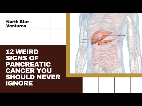 12 Weird Signs of Pancreatic Cancer You Should Never Ignore [Video]