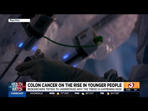 Phoenix-area doctors concerned over rise in colon cancer case in people under 50 [Video]