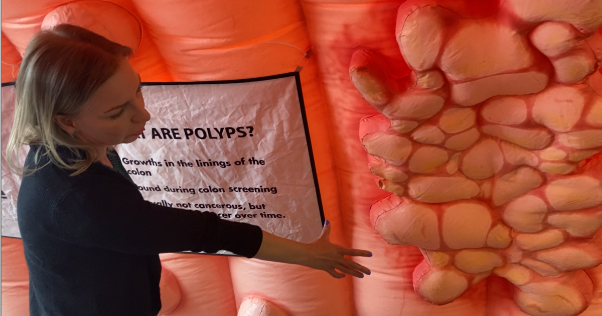 Nolan the Colon: Providence Alaska Medical Center raises awareness of colon cancer | Homepage [Video]