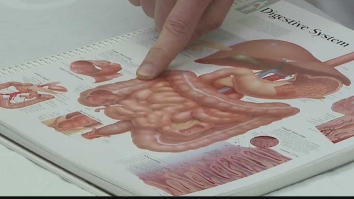 Milwaukee surgeon sees rise in colorectal cancer cases affecting young adults [Video]