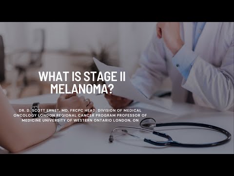 Scott Ernst – What is Stage II Melanoma? [Video]