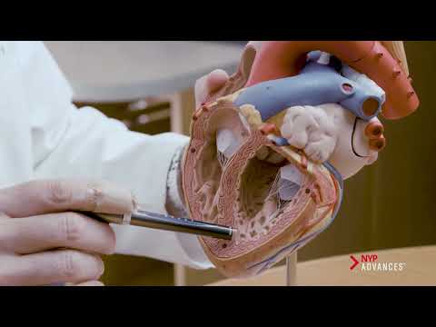 Repairing a Pediatric “Swiss Cheese Heart” [Video]
