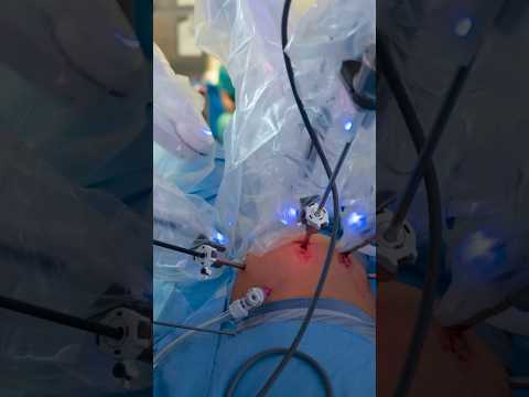 Robotic surgery: How does it work? [Video]