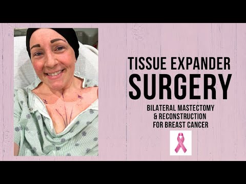 ANOTHER Surgery: Tissue Expanders | Breast Cancer | Reconstruction | Invasive Ductal Carcinoma [Video]