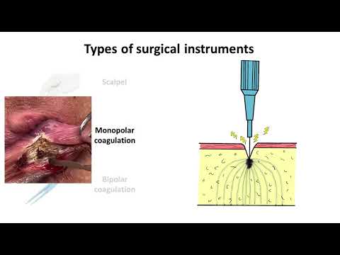 Seamless open excisional hemorrhoidectomy – six faces of surgical technique [Video]