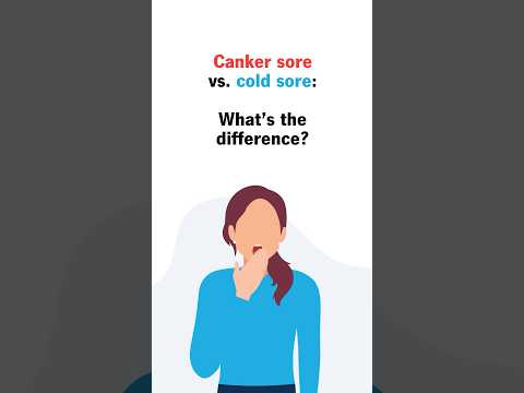 Canker sore vs cold sore: What’s the difference? [Video]