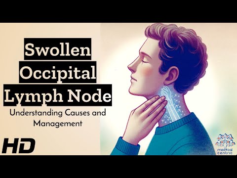 Swollen Occipital Lymph Node: What’s Behind It? [Video]