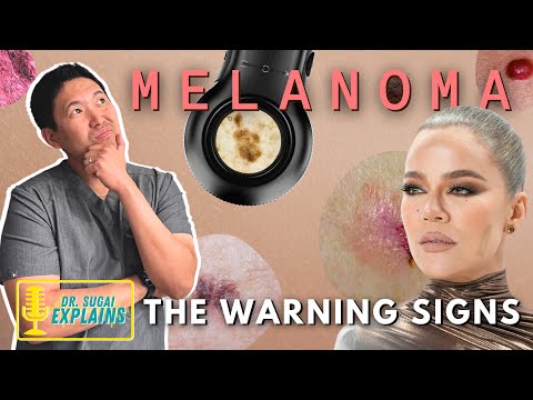 Dermatologist Explains: Warning Signs of Skin Cancer [Video]