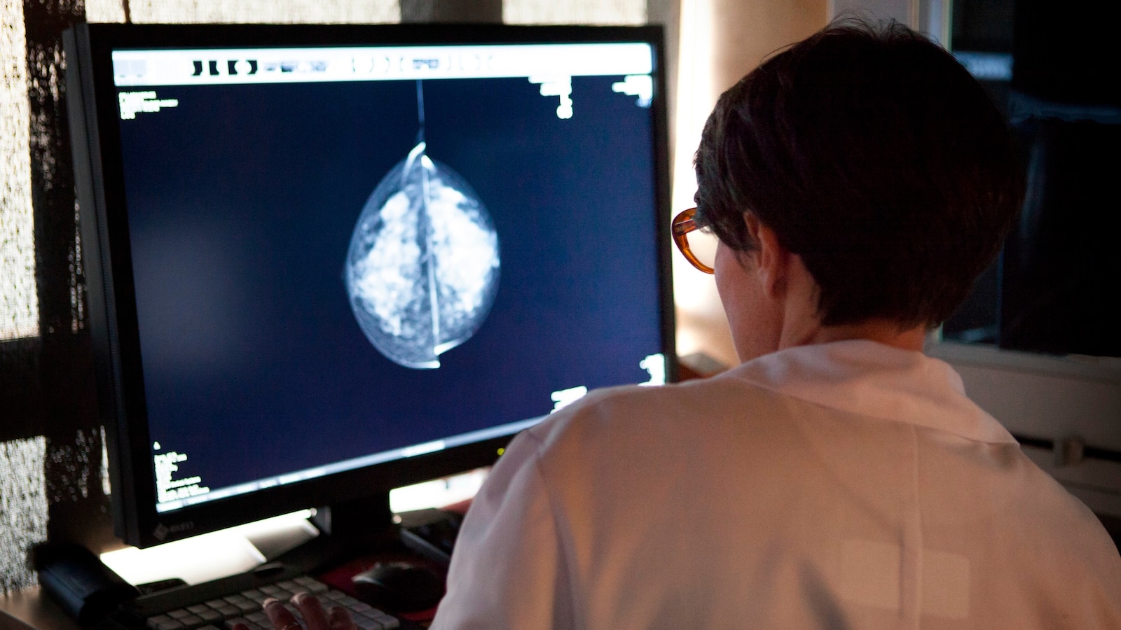 About one-third of socially vulnerable women missing recommended mammograms: CDC [Video]