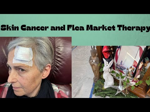 Tour the Flea Market Antique Mall for Spring Ideas – Skin Cancer Mohs Surgery Getting on With LIFE [Video]