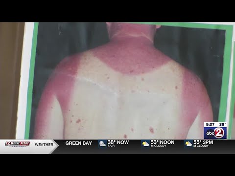 Kewaunee County hosts free skin cancer screening [Video]